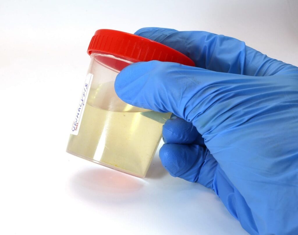 Rising Antibiotic Resistance in UTIs: What You Need to Know