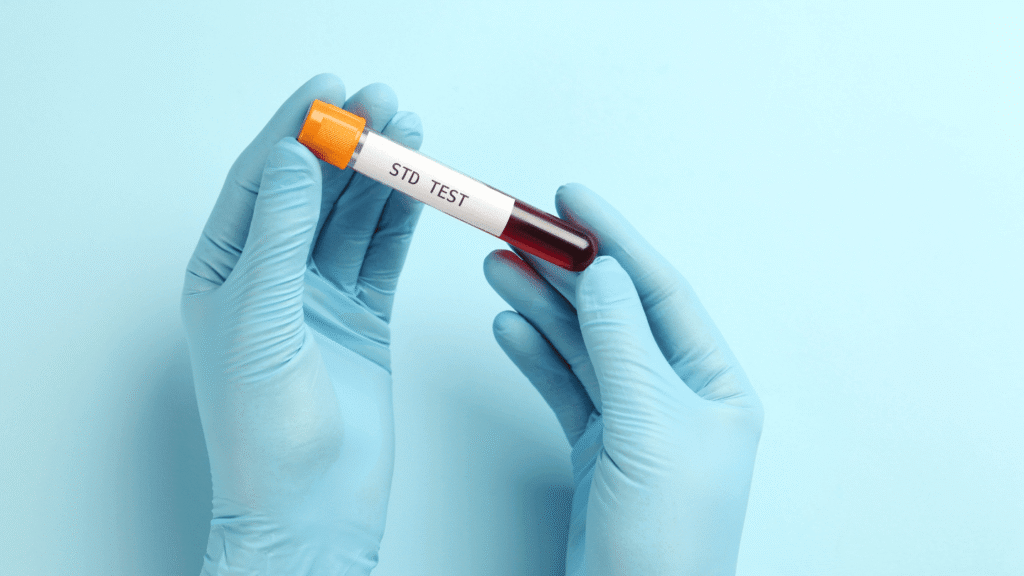 Do I Need an STD Test to Be Treated for Chlamydia?