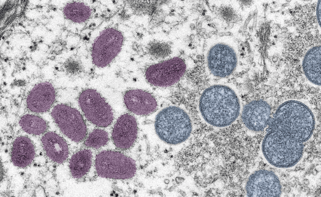 How Contagious Is Monkeypox? Understanding Transmission and Precautions