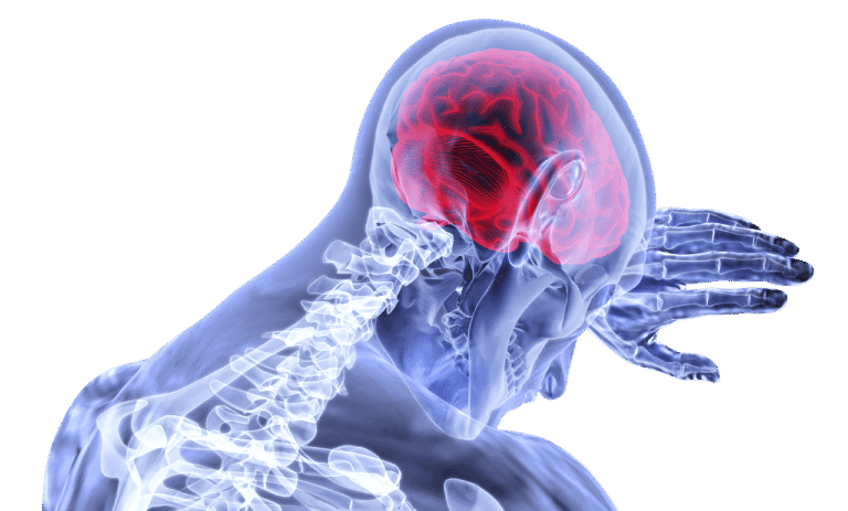 Post-Herpetic Neuralgia