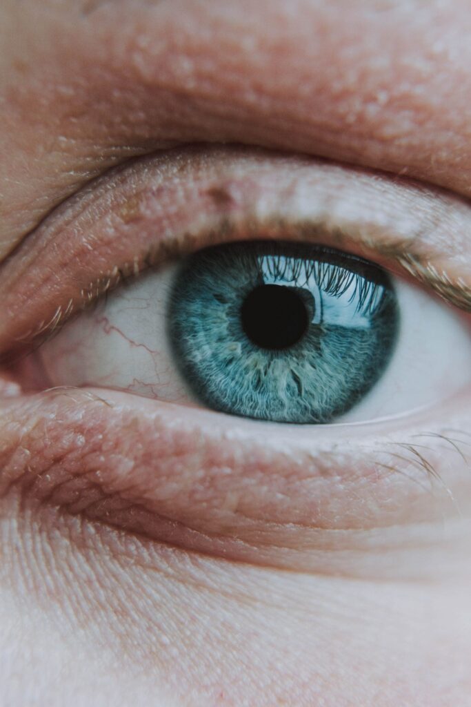 Chalazion vs Hordeolum (Stye): Causes, Symptoms, and Treatment Options